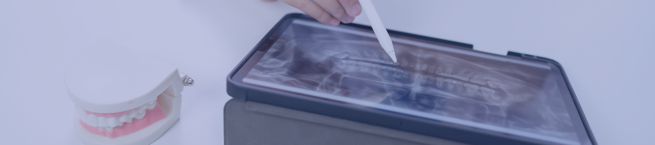 Cómo mejorar la gestión de pacientes en odontología - Nexup